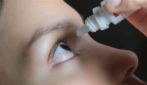 Woman Prescribed Erectile Dysfunction Cream Instead Of Eye Cream Extra Ie
