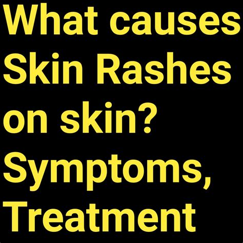 Healthcare And Health Solution What Causes Skin Rashes On Skin Symptoms