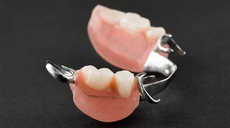 Artificial Teeth Things To Know Sri Aakrithis Dental Lounge And