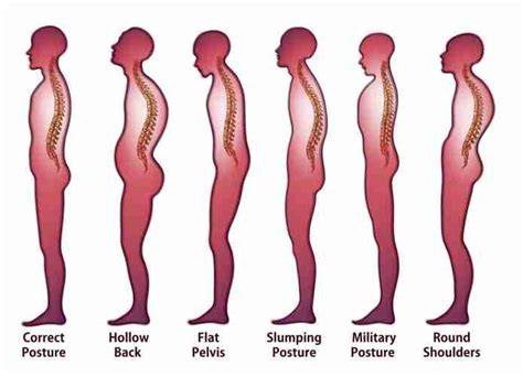 Observe ‘correct Your Posture Month With These Helpful Tips