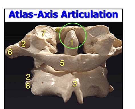 Atlas Axis Articulation Diagram Quizlet