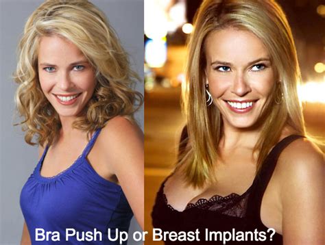 Chelsea Handler Plastic Surgery Before And After Photos