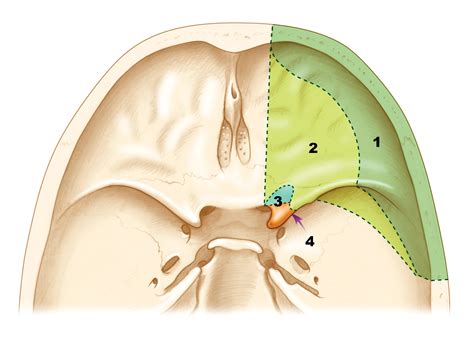 Orbitozygomatic Approaches Skull Base Surgery Atlas