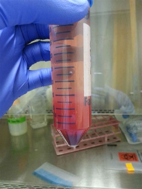 Can Anyone Help With Problems With Density Gradient Percoll Pbmc