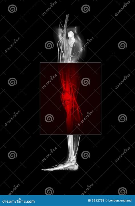 Leg Bones Arteries Veins Stock Image 3018313