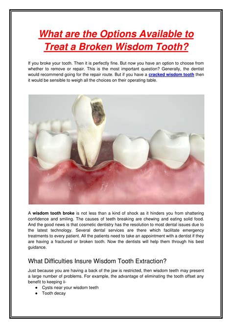 Ppt What Are The Options Available To Treat A Broken Wisdom Tooth
