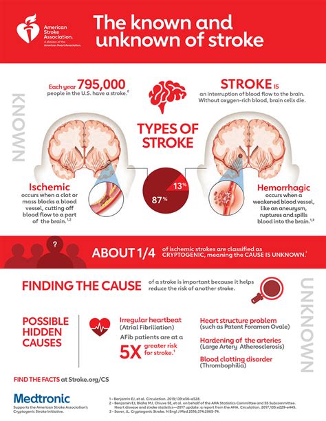 The Known And Unknown Of Stroke Infographic American Stroke Association