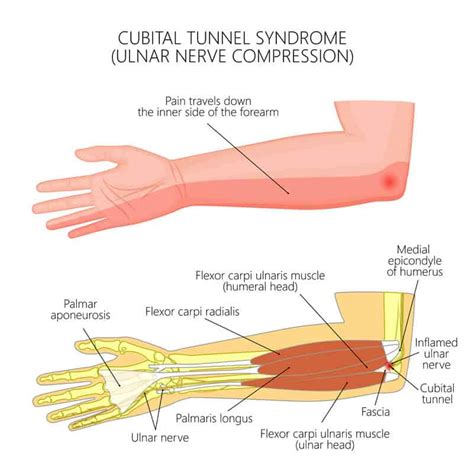 Ulnar Nerve Anatomy Hand