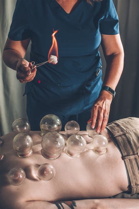 Cupping Therapy Near Me Soul Sprout Acupuncture