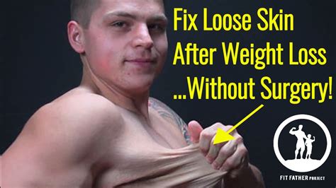 15 Inspiring Loose Skin After Weight Loss Surgery Best Product Reviews