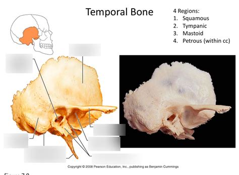 Temporal Bone Diagram Quizlet