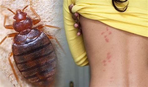 How To Handle A Bed Bug Infestation In Malaysia Bernama News Channel