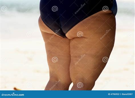 Obese Woman Touching Saggy Belly Overweight Insecurities Problem Unsatisfied Royalty Free