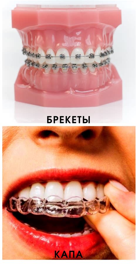 какой правильный прикус зубов у человека фото