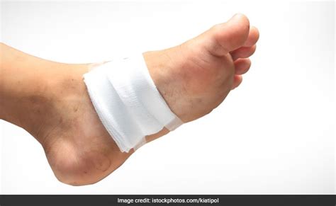 Are You Diabetic New Shoe Insole Could Help Treat Foot Ulcers