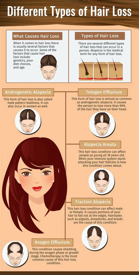ppt different types of hair loss powerpoint presentation id 7259392