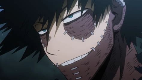 How Did Dabi Get His Scars