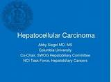 Hepatocellular Carcinoma Treatment Options Pictures