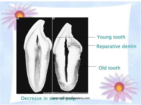 Age Changes In Oral Tissues Certified Fixed Orthodontic Courses By