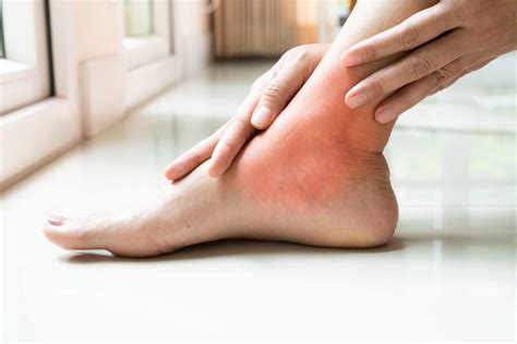 How To Treat Bursitis In Your Feet Desert Podiatric