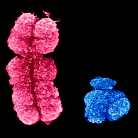 Rna Sequencing Provides New Insights Into Infertility Causing Sex