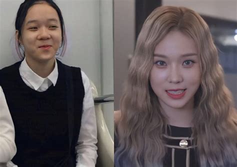 Plastic Surgery Accusations Come Up After Netizens Discovered How