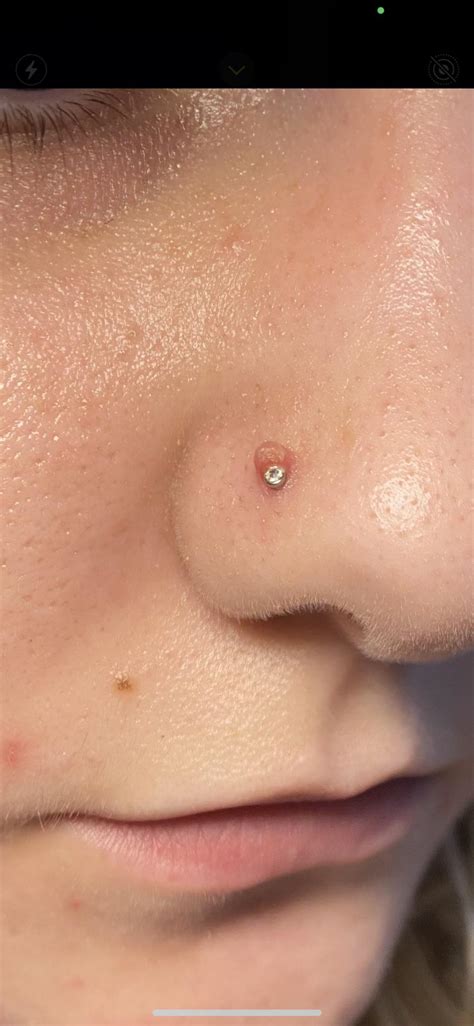 Thinking Of Retiring My 8 Month Old Nose Piercing As I Think It Was Pierced A Tad Too Low How