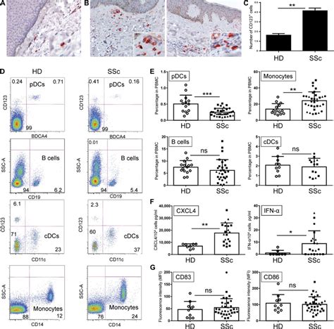 Plasmacytoid Dendritic Cells Promote Systemic Sclerosis With A Key Role