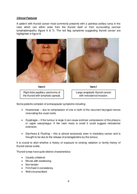 Skin cancers usually present as an abnormal growth on the skin. Thyroid Cancer & Differential Diagnosis of Lumps in Neck ...