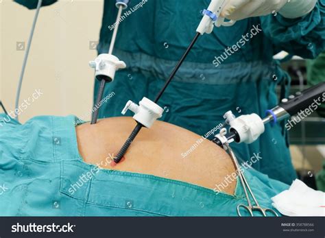 Laparoscopic Cholecystectomylc It Mean Gallbladder Surgeryn Ad