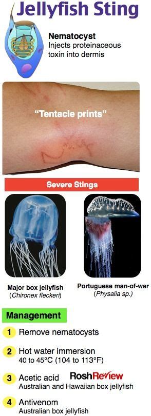 Jellyfish Sting Emergency Medicine Medical Mnemonics Medicine