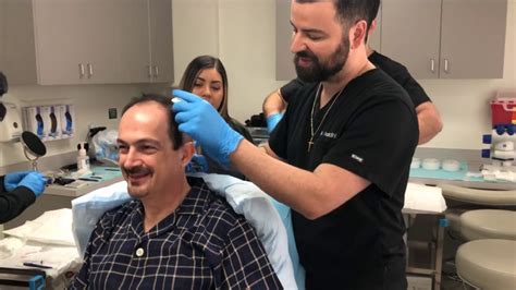 For this video i took another look at some past results of dr. FUE Hair Transplant Surgery in Los Angeles and FUE Hair ...