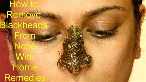 How To Remove Blackheads From Nose With Home Remedies Get Rid Of