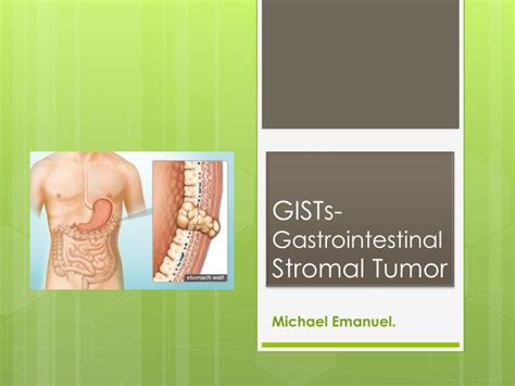 Ppt Gists Gastrointestinal Stromal Tumor Powerpoint Presentation