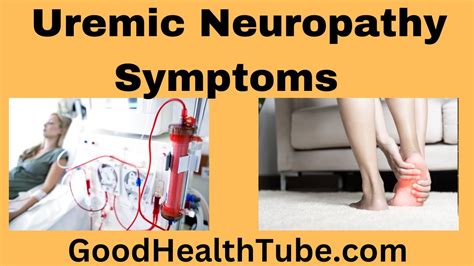 Uremic Neuropathy Symptoms What Are They Good Health Tube YouTube