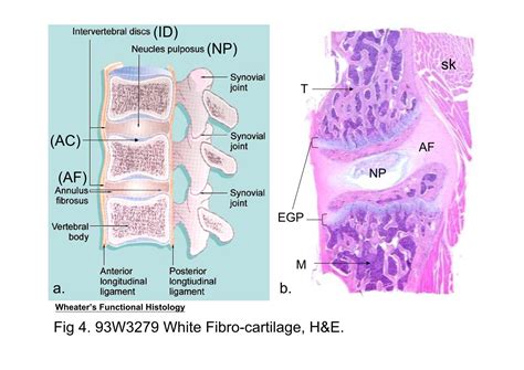 White Fibrocartilage Under Microscope Micropedia