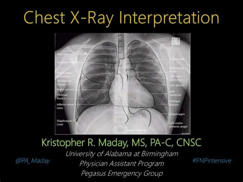 Introduction To Chest X Ray Interpretation