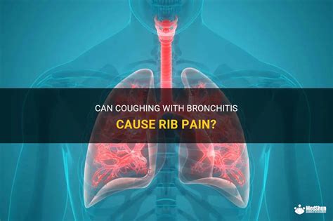 Can Coughing With Bronchitis Cause Rib Pain Medshun