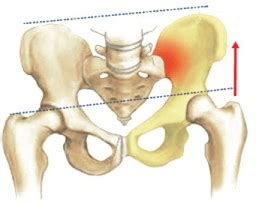 Lower back pain most commonly comes from a muscle strain or lumbar strain. A Pain in the Butt; the Piriformis Muscle is the Scapegoat of Sciatica pain - More To Life ...