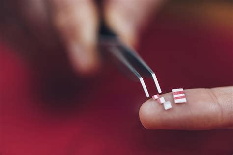 LSD may offer viable treatment for certain mental disorders | Newsroom