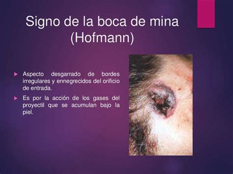 Câmara De Mina De Hoffmann