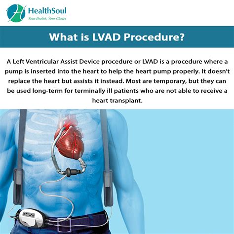 Lvad Procedure Cardiac Surgery Healthsoul