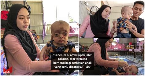 Batuk berdahak dan pilek berkepanjangan: Derita bebola mata hampir terkeluar, bayi 9 bulan perlu ...