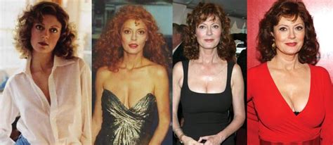 Susan Sarandon Plastic Surgery Before And After Pictures