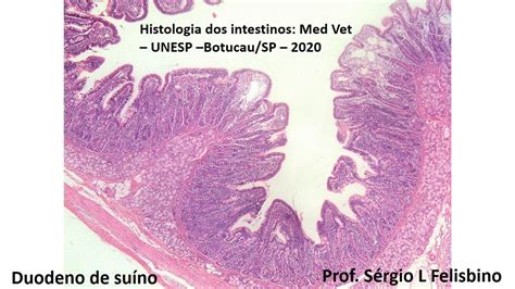 Histologia Do Sistema Digestório Intestinos Youtube