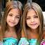 Identical Twins Were Born In 2010  Now Theyre Dubbed The Most