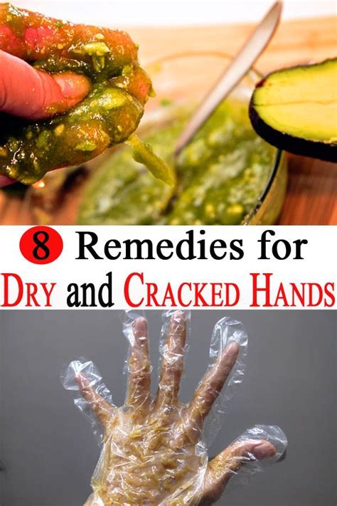 Simple Skin Care Tips And Advice For You Cracked Hands Dry Hands
