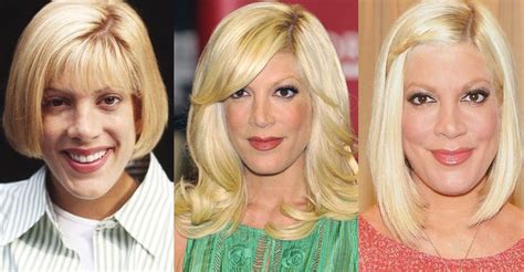 Tori Spelling Plastic Surgery Before And After Pictures 2018