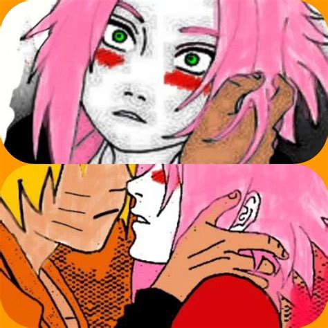 Your Eyesface And Beautiful Forehead Is So Perfect To Kiss Narusaku