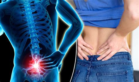 Back Pain Symptoms These Are Signs Of A Serious Condition